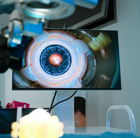 Retinal image displayed on a monitor during ophthalmic surgical simulation training